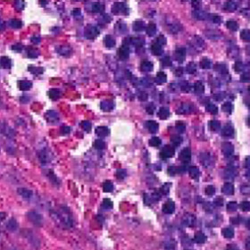 Minimum Resolution Requirements of Digital Pathology Images for Accurate Classification